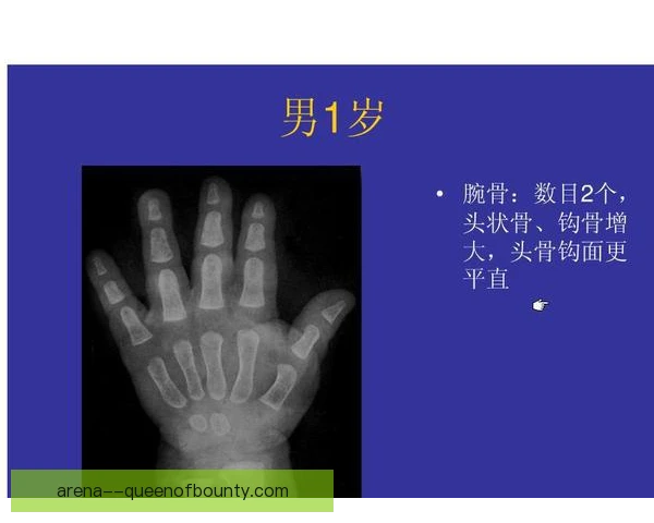 自由式滑雪骨龄评估推进，选材公平与成长保护并重